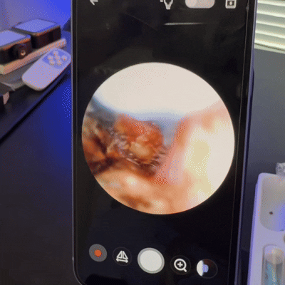 Earlio EarVision: Clinically Trusted Ear Care Technology